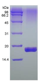 SDS-PAGE (TNFRSF10B-311H).jpg